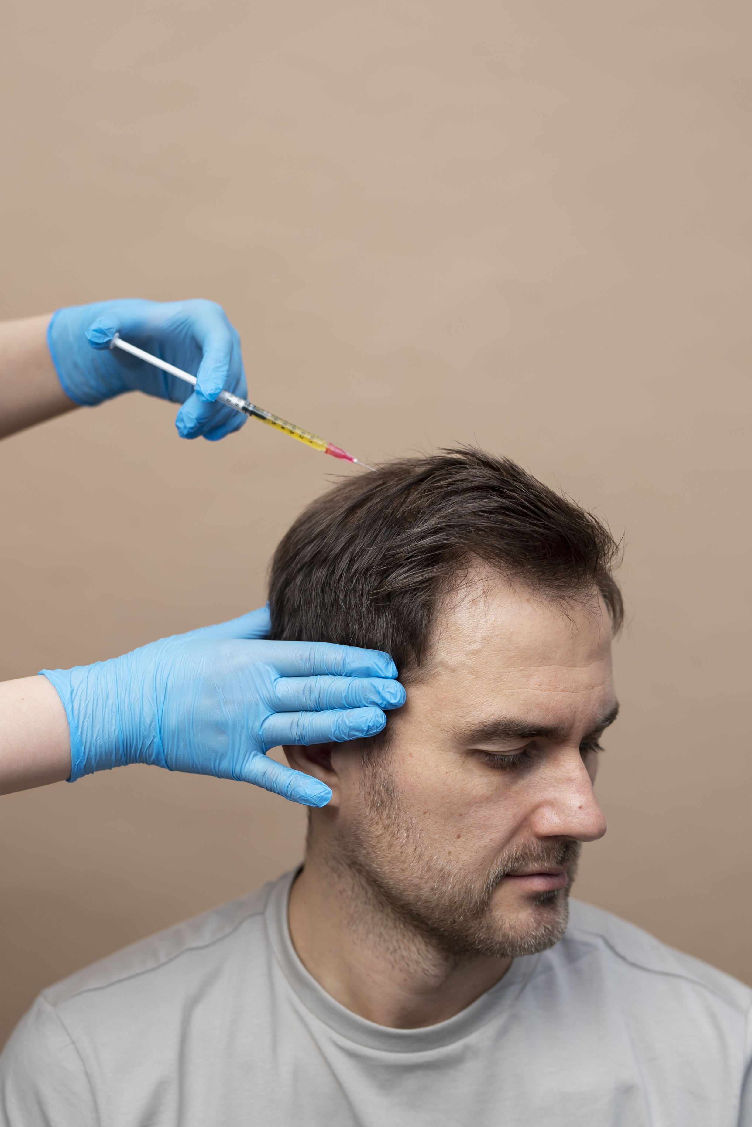 Hair restoration treatment